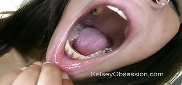 370px x 172px - Mouth Fetish â€“ Dental Exam, Katrina Kox at KelseyObsession.net